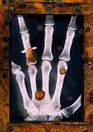Hand X-Ray 5