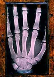Hand X-Ray 3