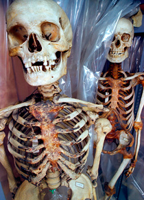 human skeleton storage